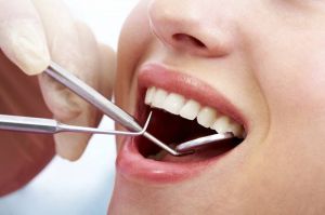 Tẩy trắng răng nhanh trong 1h